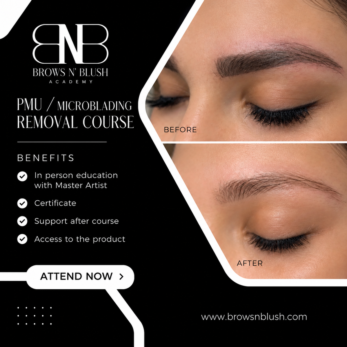 Permanent Make Up and Microblading Removal Education